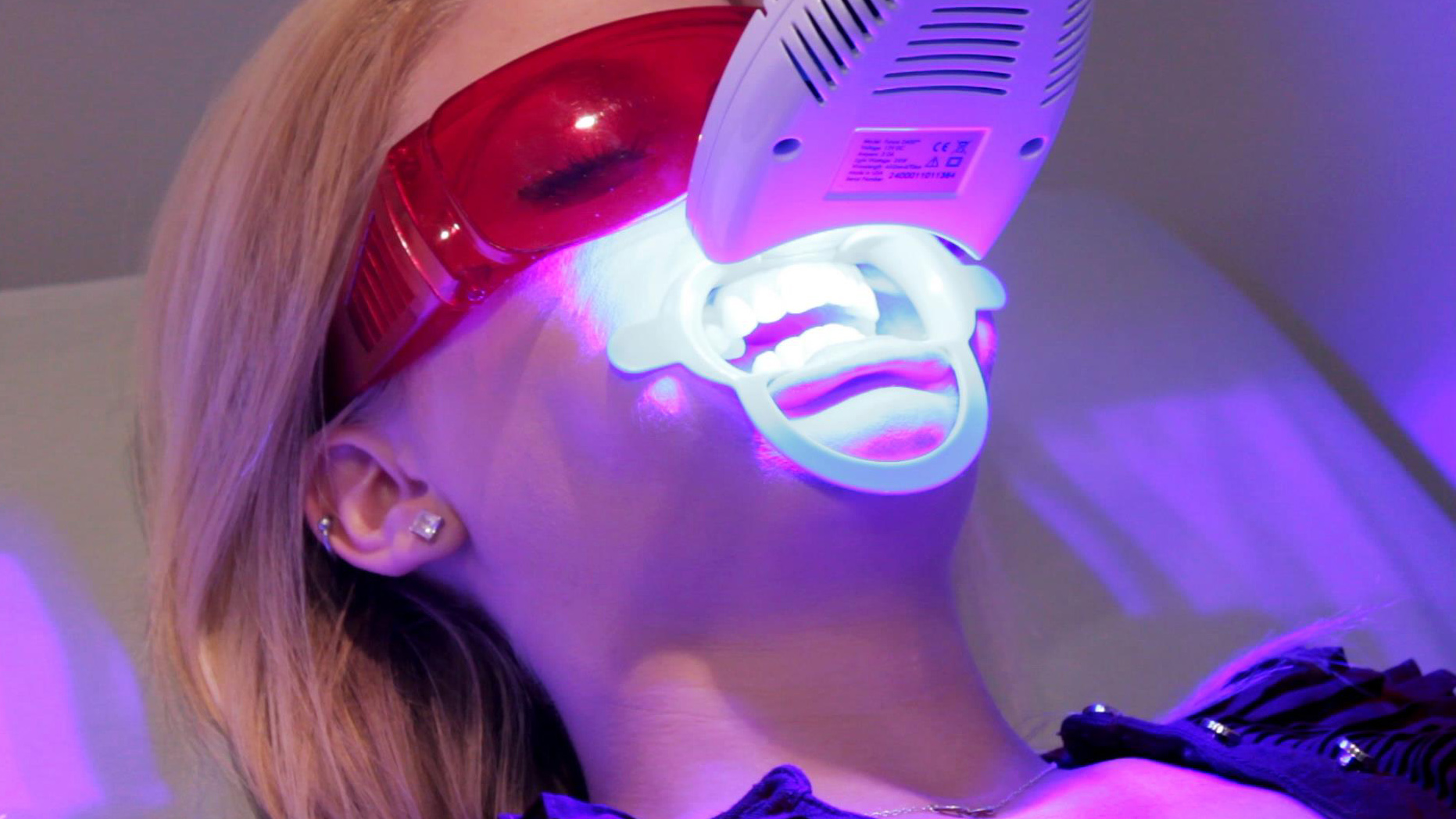 Tẩy trắng răng an toàn hiểu quả cao với công nghệ Laser Whitening