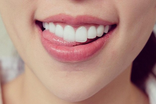 Các bước bọc răng sứ bạn nên biết