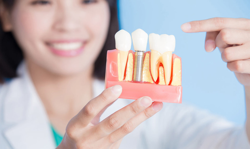 răng implant ko ảnh hưởng răng khác