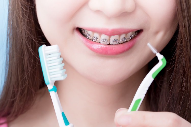 Do chăm sóc răng miệng không đúng cách