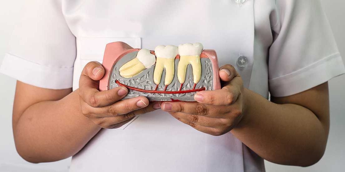 kĩ thuật nhổ răng