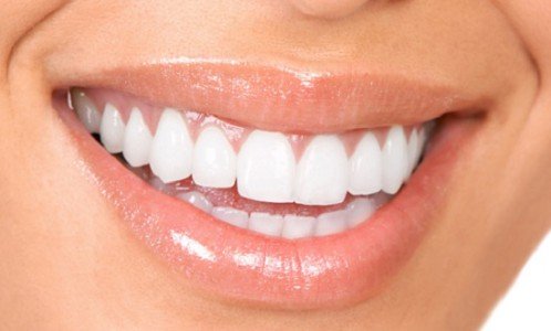 hàm răng trắng đẹp