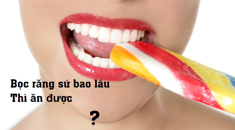 SAU KHI BỌC RĂNG SỨ BAO LÂU THÌ ĂN UỐNG BÌNH THƯỜNG ĐƯỢC ?