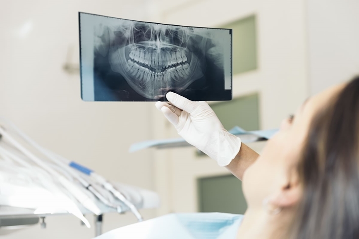 chụp X-quang để xác định tình trạng răng