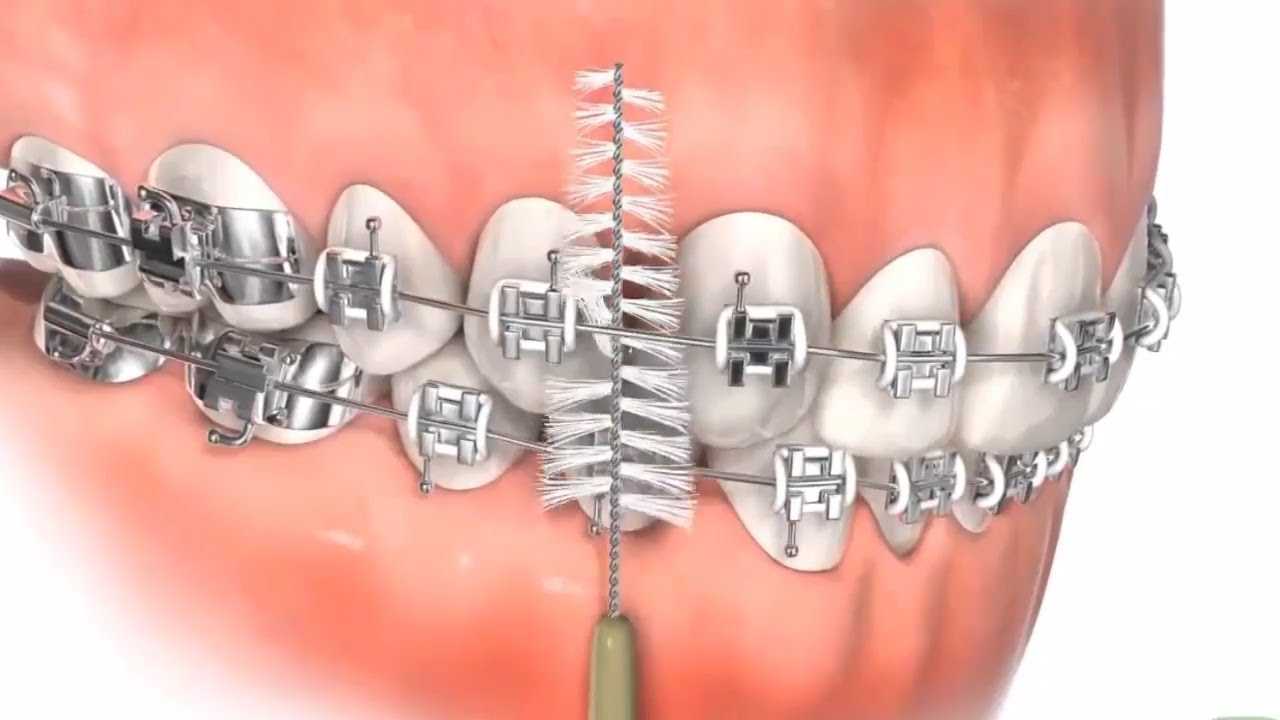 xác định sai khuyết điểm của răng