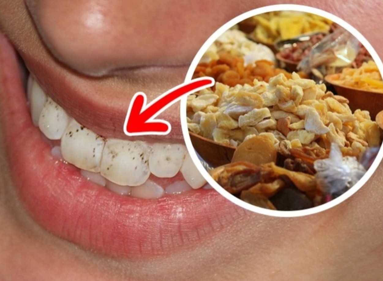 thực phẩm ảnh hưởng tới màu răng