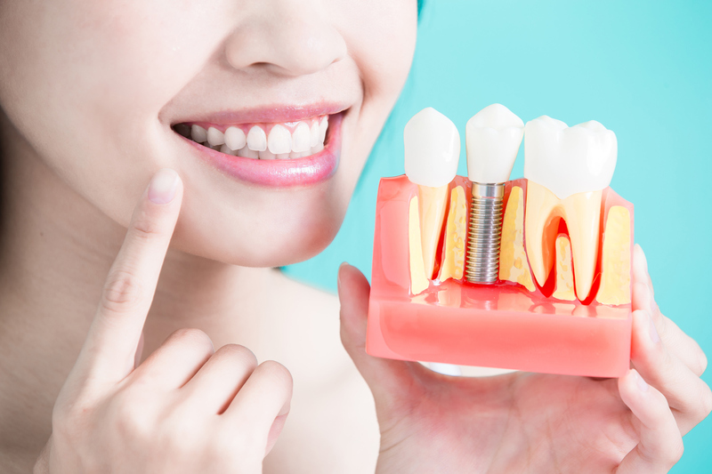 Nhổ răng và trồng Implant ngay trong một buổi điều trị có được không?