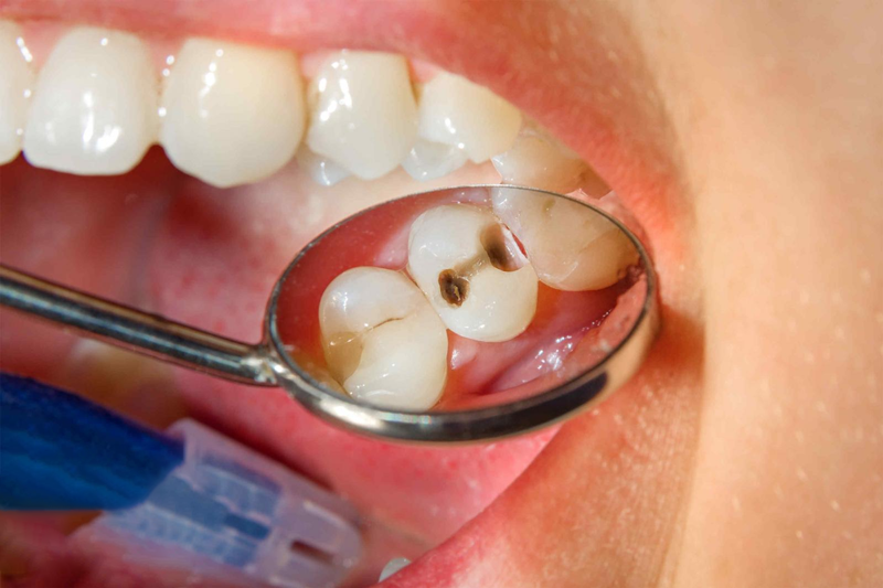 Nếu có dấu hiệu bất thường nào về răng nên đến nha khoa để được chẩn đoán kịp thời