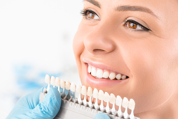 Bọc răng sứ là phương pháp thẩm mỹ được ưa chuộng hiện nay