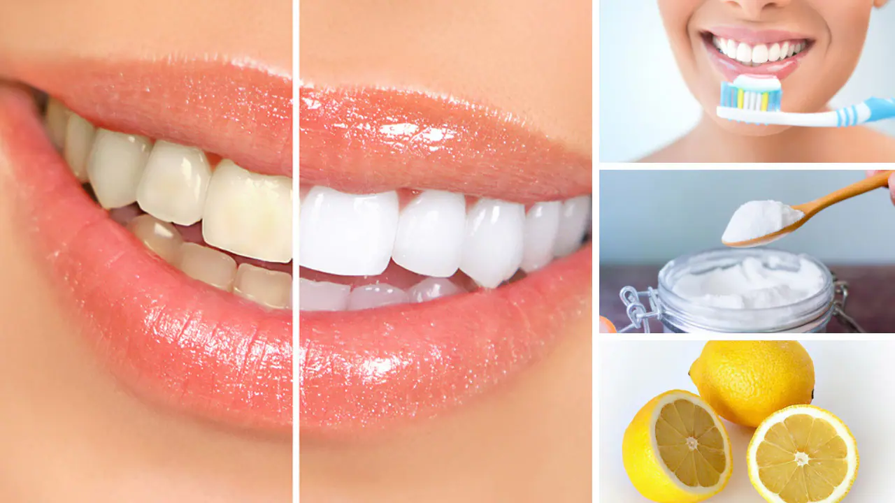 Có nhiều phương pháp làm trắng răng ố vàng tại nhà