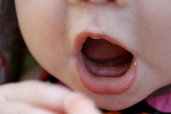 Chồi răng là dấu hiệu của răng bé sắp mọc
