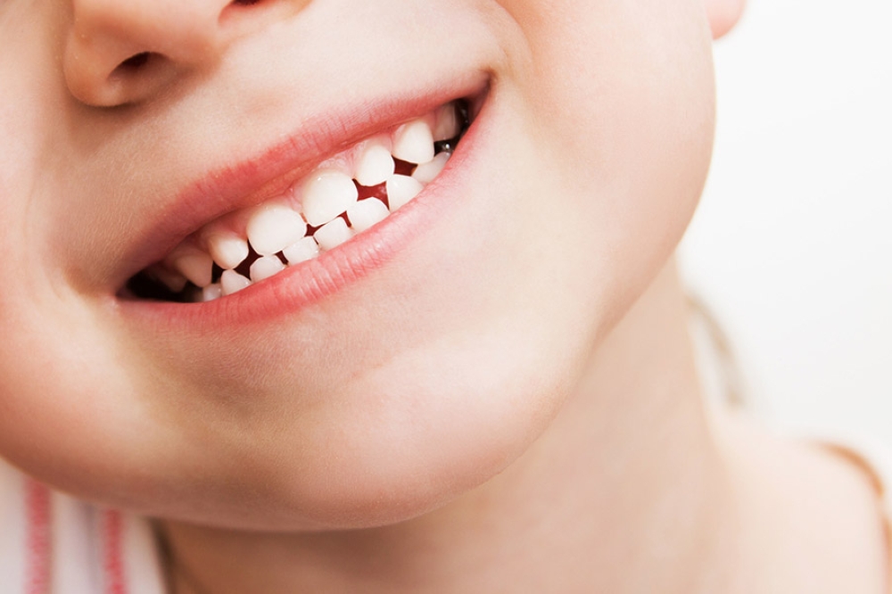 Răng sữa thường có những dấu hiệu trước khi thay