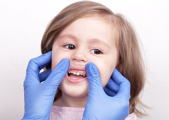 Nên đưa trẻ đến nha khoa để khám khi tình trạng sún răng phát triển nặng