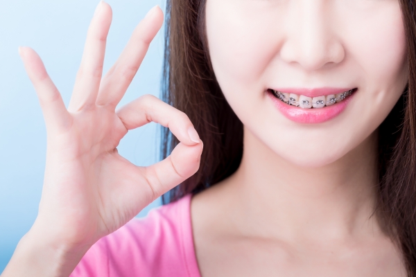 Khi đang niềng răng vẫn có thể tiến hành phun môi
