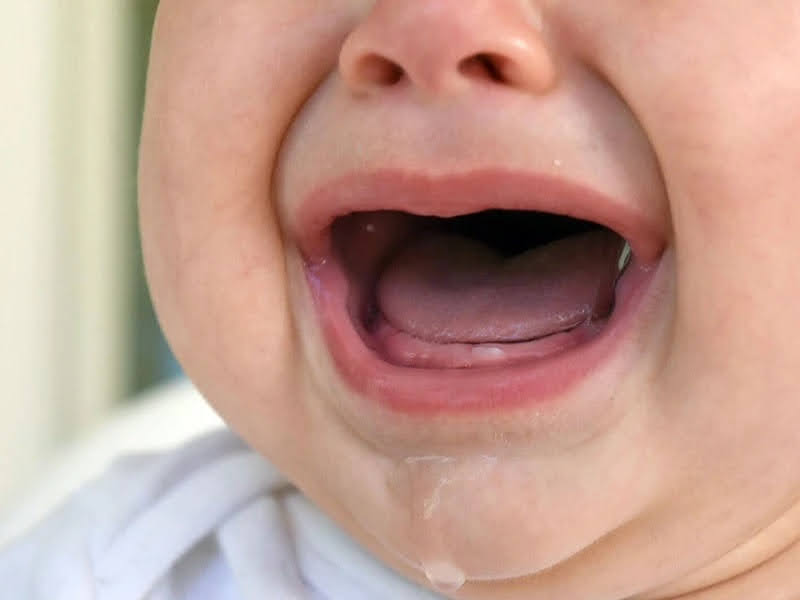 Trẻ nhỏ dễ chảy nước dãi trong giai đoạn mọc răng
