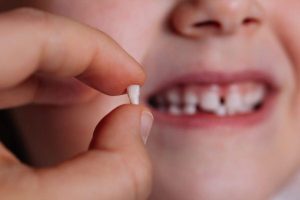 Độ tuổi mọc và thay răng sữa của con ba mẹ cần lưu ý