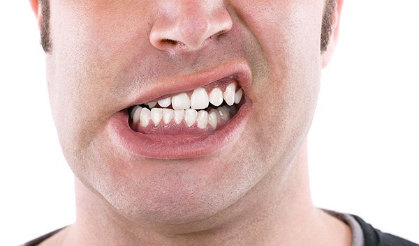 Thói quen nghiến răng có gây ảnh hưởng đến răng implant hay không?