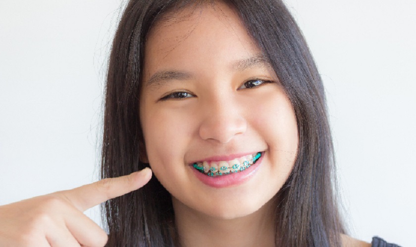 Niềng răng cho trẻ sớm tránh gây đau đớn