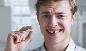 Cách khôi phục lại thẩm mỹ và khả năng ăn nhai khi bị gãy răng