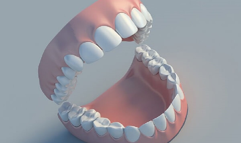 Răng hàm lớn