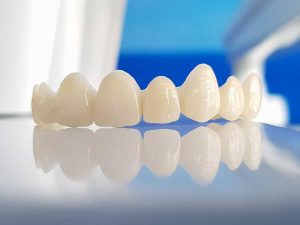 Những yếu tố và tác động ảnh hưởng đến tuổi thọ của răng sứ