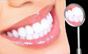 Men răng có bị ảnh hưởng sau khi tẩy trắng răng hay không?