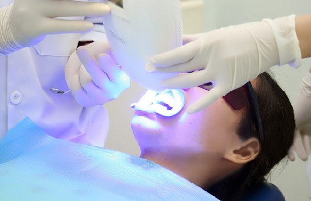 Tẩy trắng răng bằng công nghệ Laser Whitening 