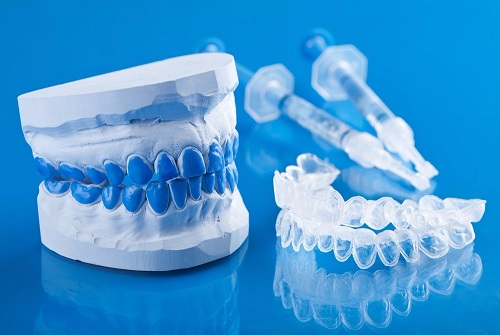 Máng tẩy trắng răng được sử dụng phổ biến vì chi phí rẻ nhưung mang lại hiệu quả cao