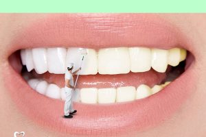 Tẩy trắng răng – Những cách hiệu quả và an toàn mà bạn nên biết