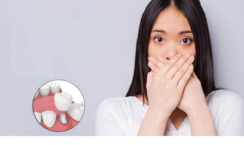 Nguyên nhân trồng răng implant bị hôi miệng