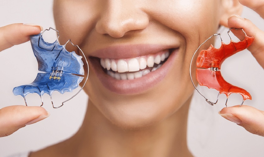 Tùy cấu trúc răng sẽ đeo hàm duy trì phù hợp